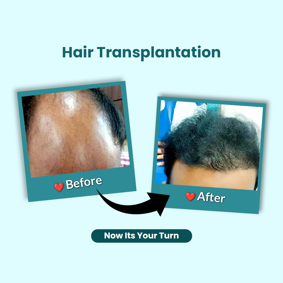 Before & After 1
